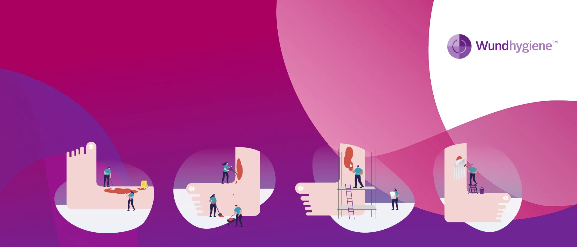 Grafische Darstellung der vier Schritte für eine optimale Wundversorgung und Wundhygiene.