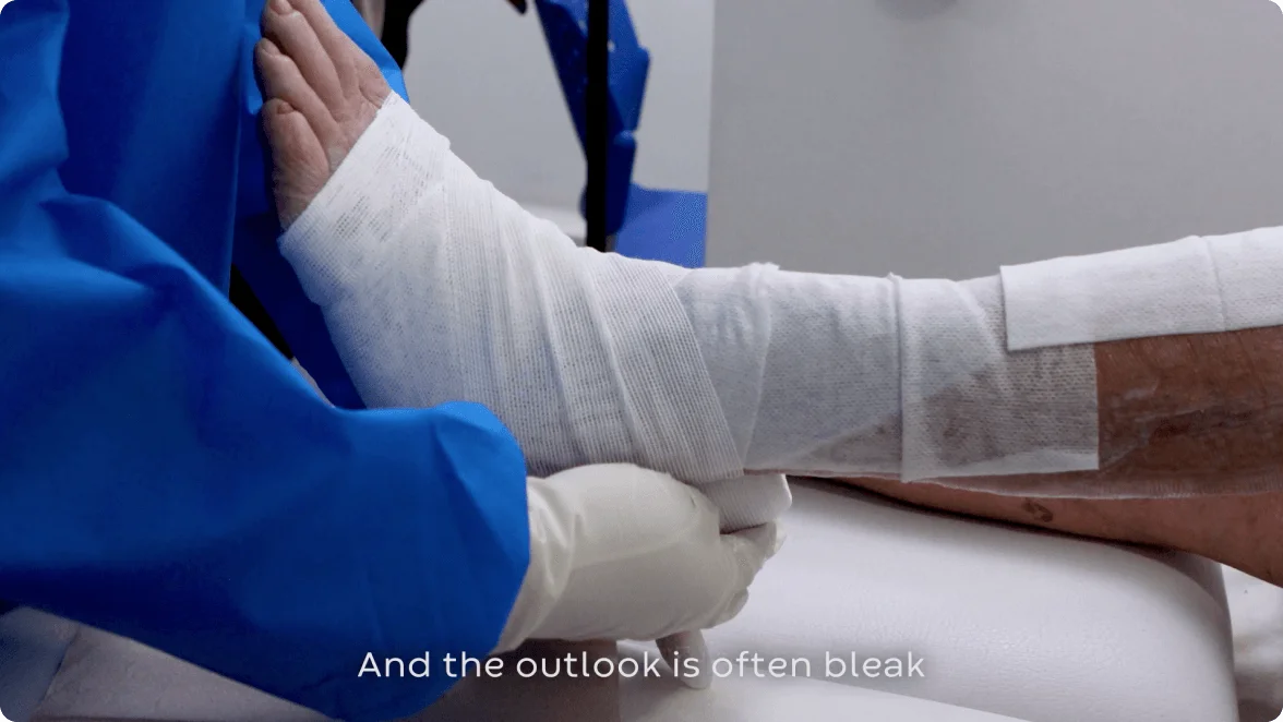 A close-up view of a healthcare professional carefully wrapping a bandage around a patient's leg