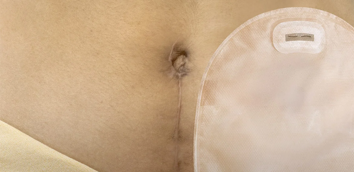 Un plafond blanc avec un plafond blanc