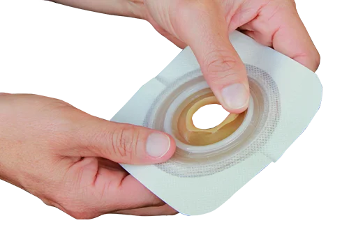 Technologie malléable de Convatec